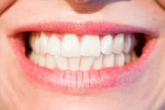 Teeth Whitening — Dental Care in Mittagong, NSW