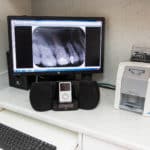 Monitor with X-ray — Dental Care in Mittagong, NSW