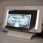X-ray with Light — Dental Care in Mittagong, NSW