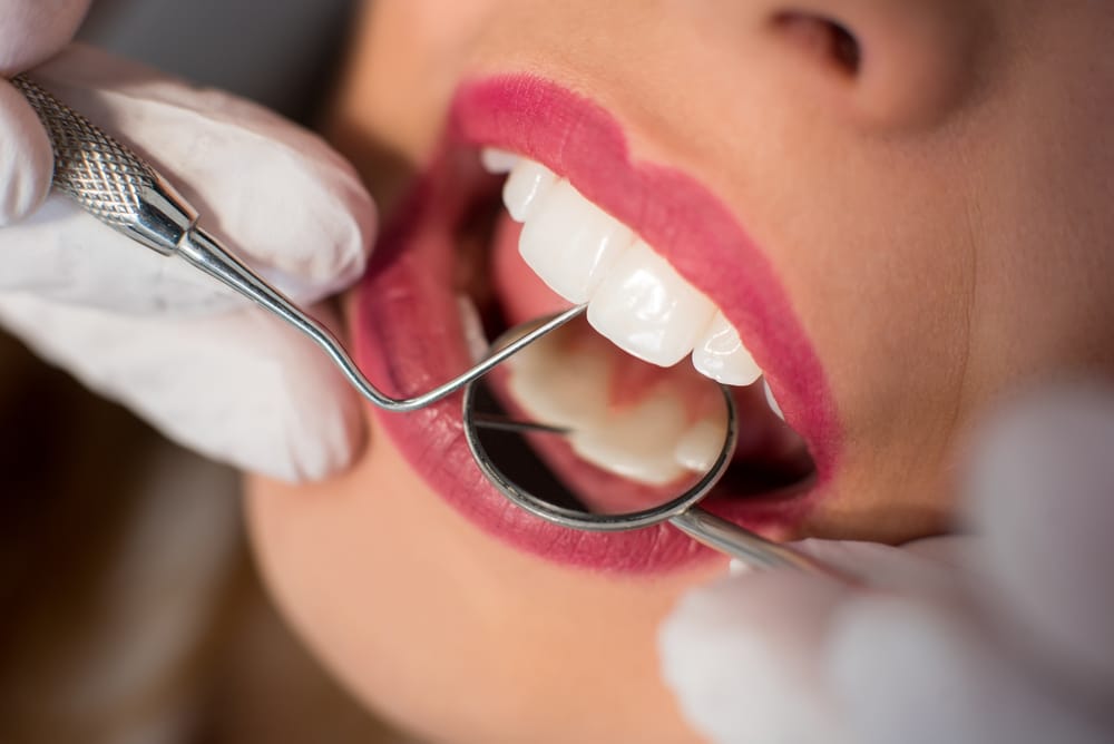 Why Regular Dental Check-ups Are Important