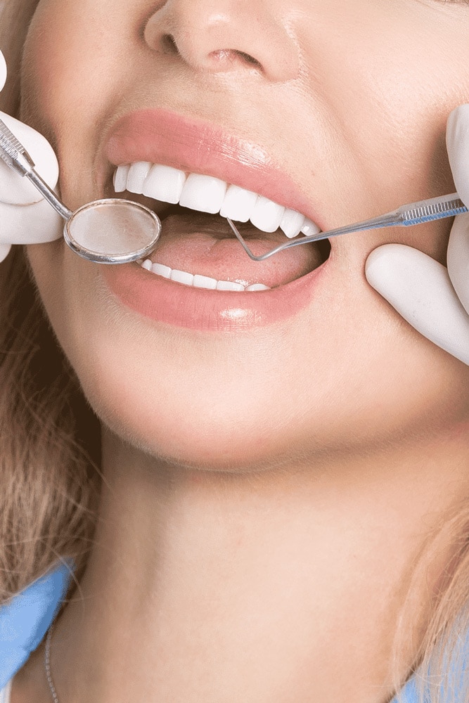 5 Things To Look Out For When Choosing A Cosmetic Dentist For Your Smile